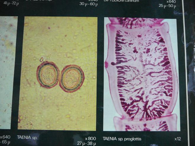 Estados de la tenia: huevos y parte del cuerpo del parásito